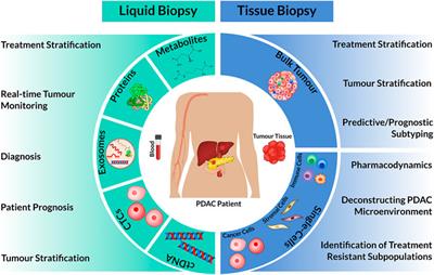 Deconstructing Pancreatic Cancer Using Next Generation-Omic Technologies–From Discovery to Knowledge-Guided Platforms for Better Patient Management